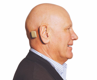 bone anchored hearing aid services